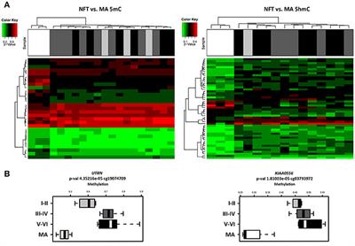 Altered Regulation of KIAA0566, and Katanin Signaling Expression in the Locus Coeruleus With Neurofibrillary Tangle Pathology